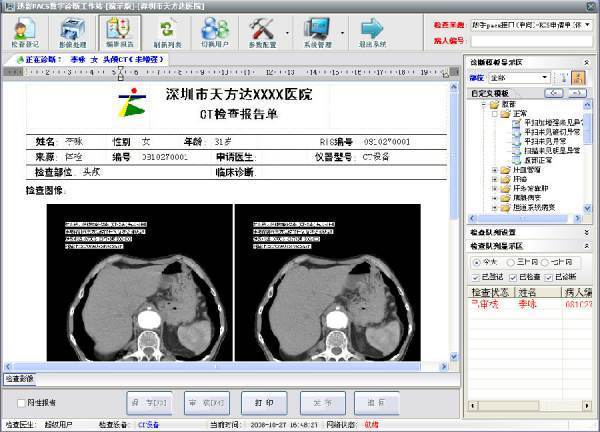 什么是pacs系统？