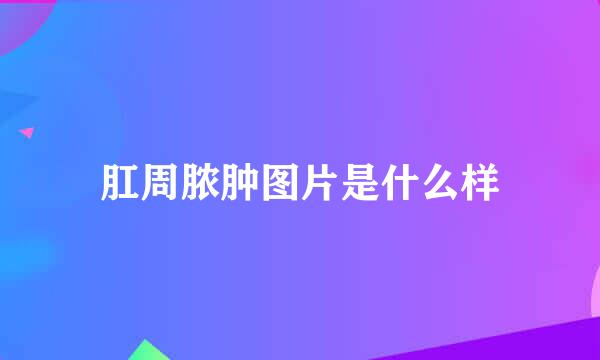 肛周脓肿图片是什么样
