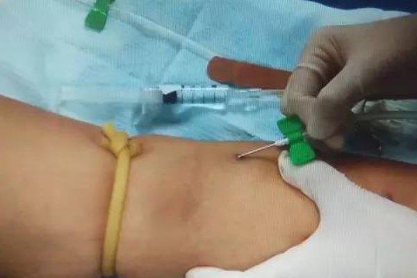 小时候注射室打针,都遇到什么尴尬事情?