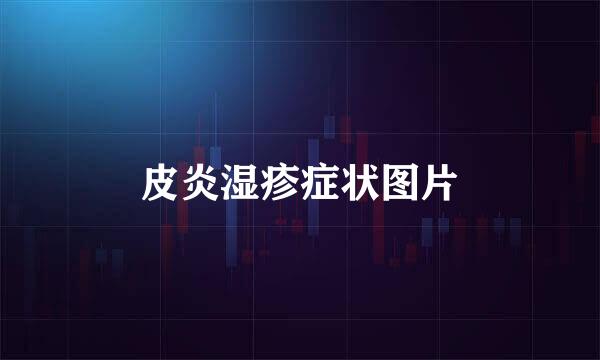 皮炎湿疹症状图片