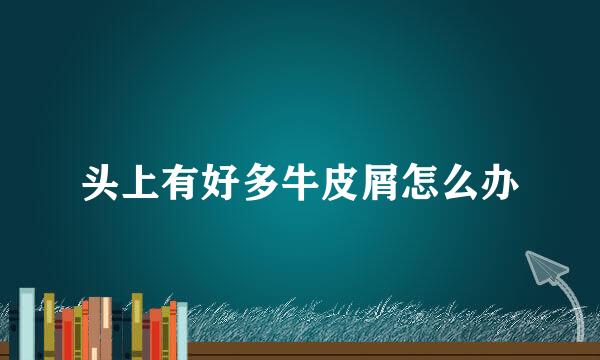 头上有好多牛皮屑怎么办