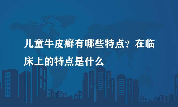 儿童牛皮癣有哪些特点？在临床上的特点是什么