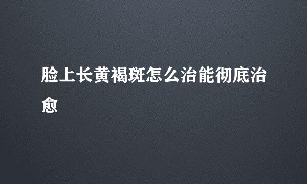 脸上长黄褐斑怎么治能彻底治愈