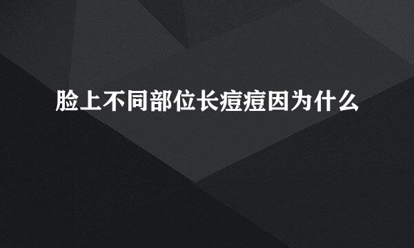 脸上不同部位长痘痘因为什么