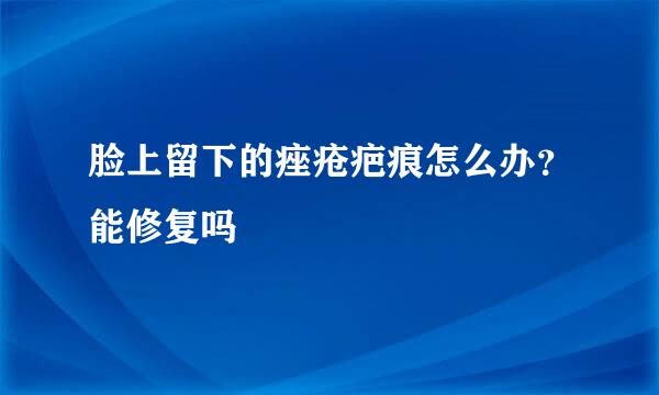 脸上留下的痤疮疤痕怎么办？能修复吗
