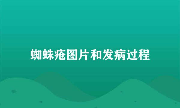 蜘蛛疮图片和发病过程