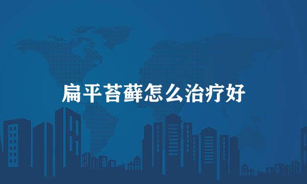 扁平苔藓怎么治疗好