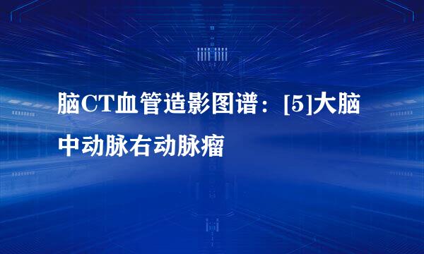 脑CT血管造影图谱：[5]大脑中动脉右动脉瘤