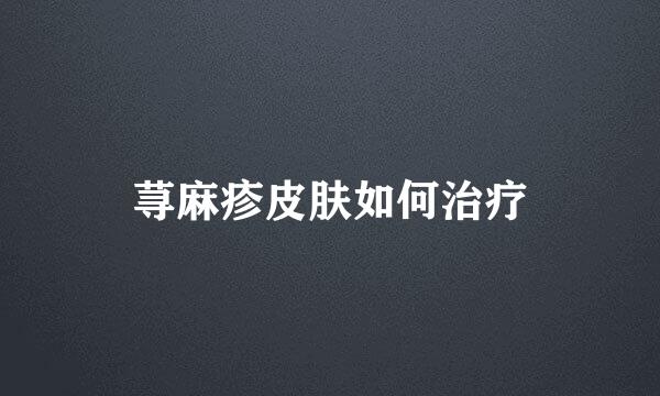 荨麻疹皮肤如何治疗