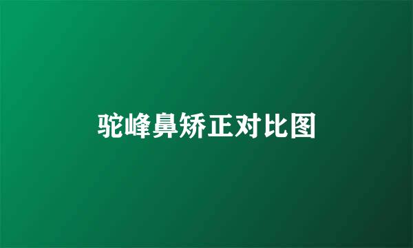 驼峰鼻矫正对比图