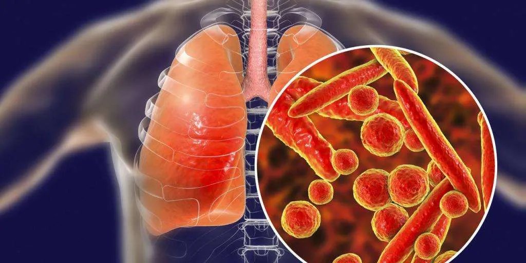 巴西总统长子确诊