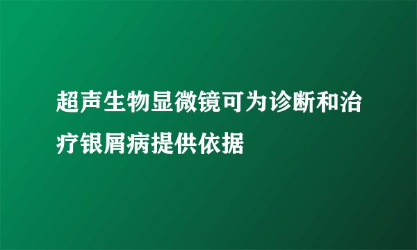 超声生物显微镜可为诊断和治疗银屑病提供依据