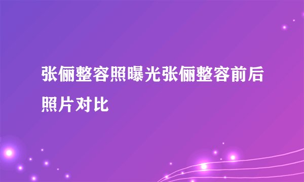 张俪整容照曝光张俪整容前后照片对比