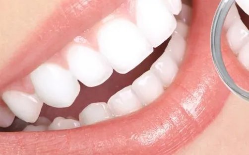 广州市种植牙价格