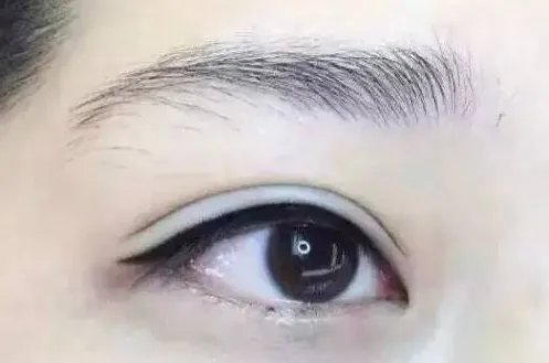 北京哪里做双眼皮好呢