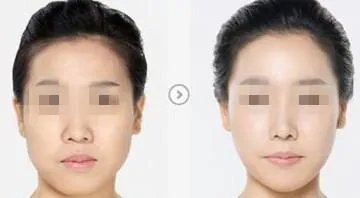 北京黑脸娃娃价格