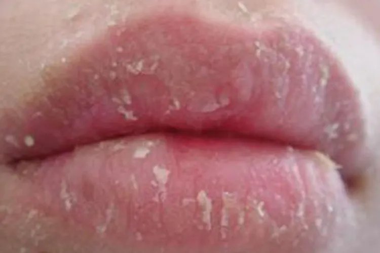 正常婴儿嘴唇图片大全