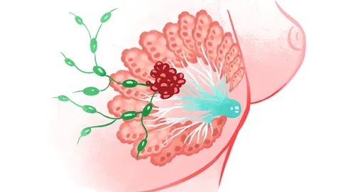 丰胸的效果怎么样