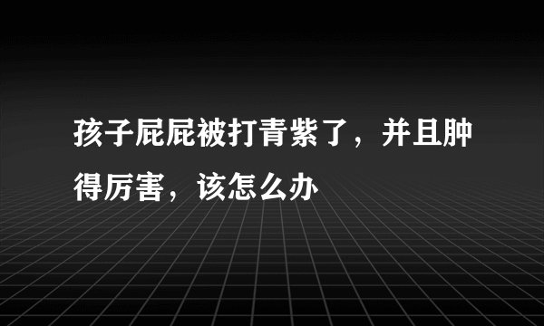孩子屁屁被打青紫了，并且肿得厉害，该怎么办