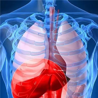 肝癌晚期的偏方都有哪些