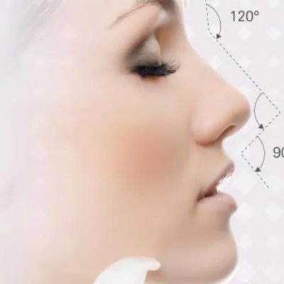 缩小鼻头手术多少钱