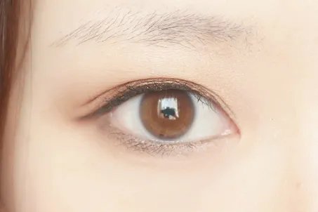 北京哪里做双眼皮好呢