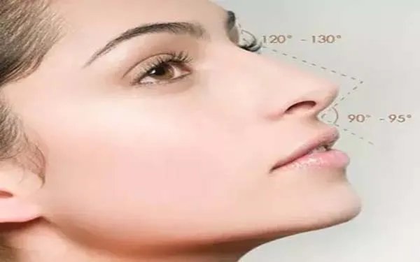 什么隆鼻最安全