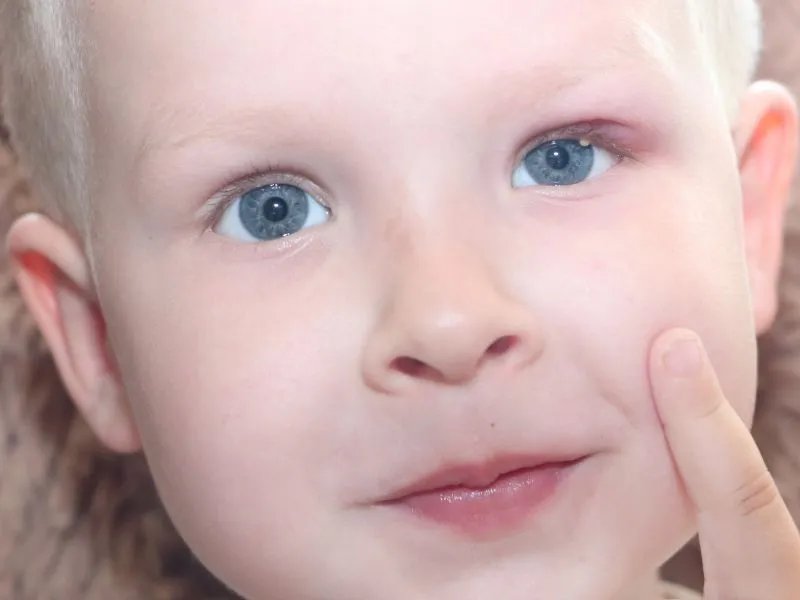 打美白针有什么好处