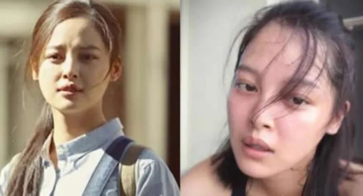 辛芷蕾整容太严重了吧：辛芷蕾整容大变形对比照