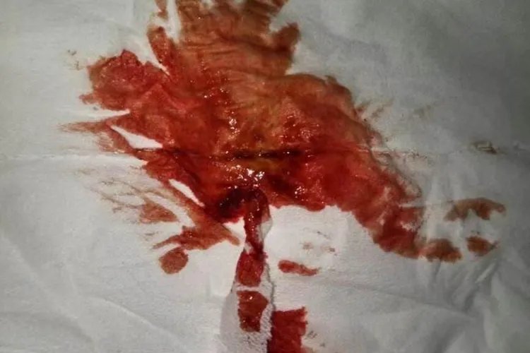 暗红色的姨妈血图片