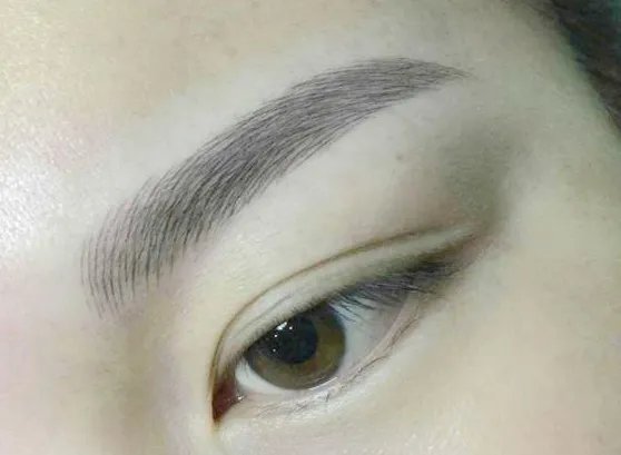 北京哪里做双眼皮好呢