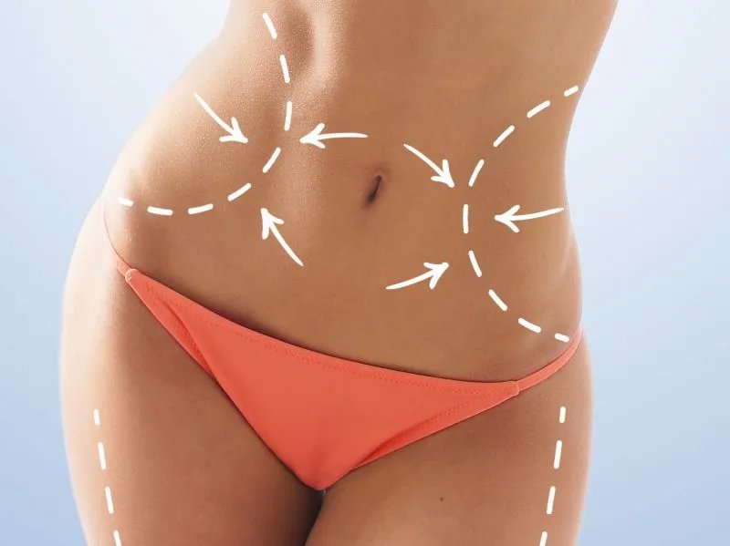 快速瘦腰的方法