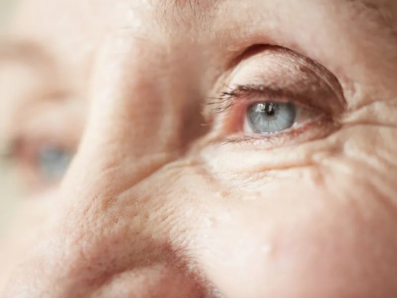 如何保养眼部皮肤