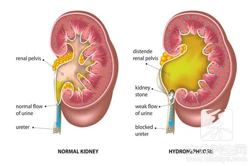 一个肾值多少钱