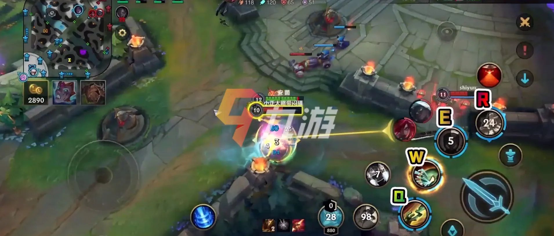 英雄联盟手游阿木木打野出装 阿木木出装推荐