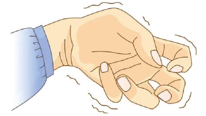 癫痫发作时应该如何正确的急救呢