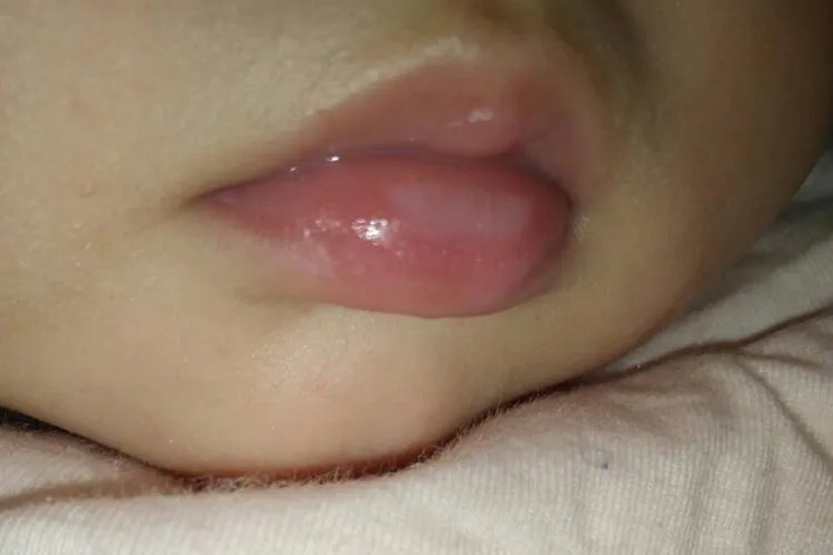 正常婴儿嘴唇图片大全