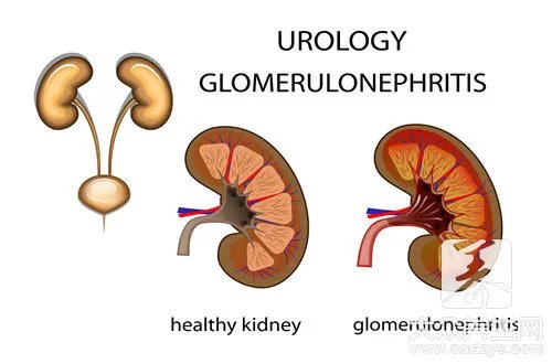 一个肾值多少钱