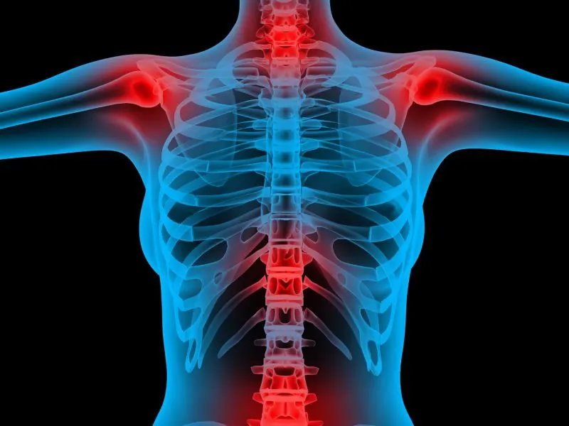 风湿热的治疗方法