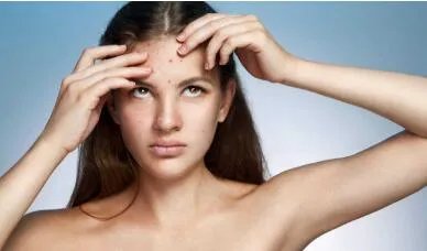 光子祛痘哪家美容院好