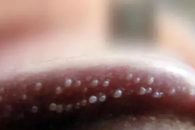 龟头上正常肉粒图片