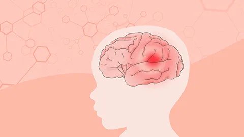 脑水肿后遗症需多久能表现出来