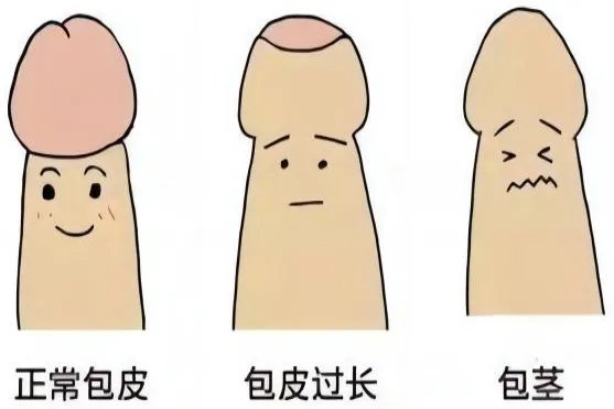 包茎图片
