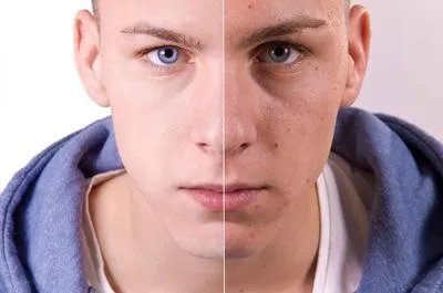 男士快速美白脸的方法