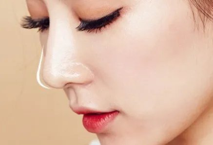 自体软骨隆鼻哪个医院好