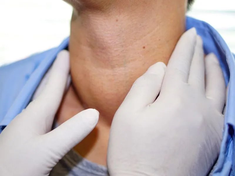 同位素治疗甲亢怎么样