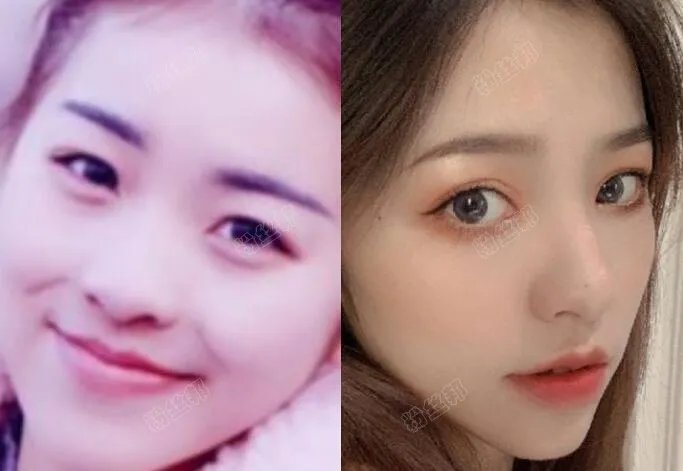 抖音刘思瑶nice现实照片 素颜照整容了吗