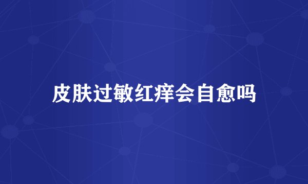 皮肤过敏红痒会自愈吗