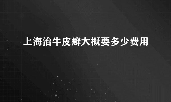 上海治牛皮癣大概要多少费用