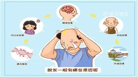 男人脱发的原因